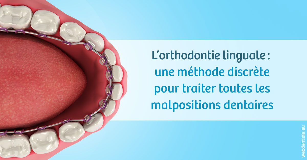 https://scp-aeberhardt-jahannot-pomel.chirurgiens-dentistes.fr/L'orthodontie linguale 1
