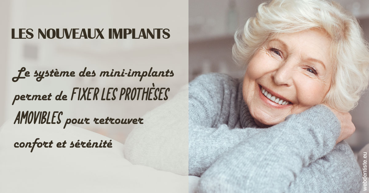 https://scp-aeberhardt-jahannot-pomel.chirurgiens-dentistes.fr/Les nouveaux implants 1