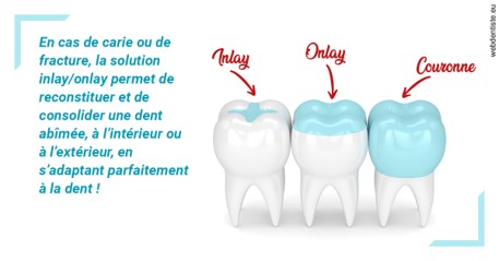 https://scp-aeberhardt-jahannot-pomel.chirurgiens-dentistes.fr/L'INLAY ou l'ONLAY