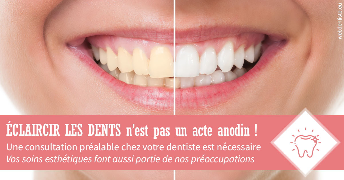 https://scp-aeberhardt-jahannot-pomel.chirurgiens-dentistes.fr/Eclaircir les dents 1