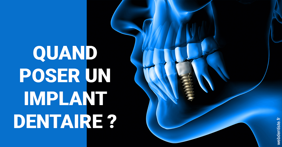https://scp-aeberhardt-jahannot-pomel.chirurgiens-dentistes.fr/Les implants 1