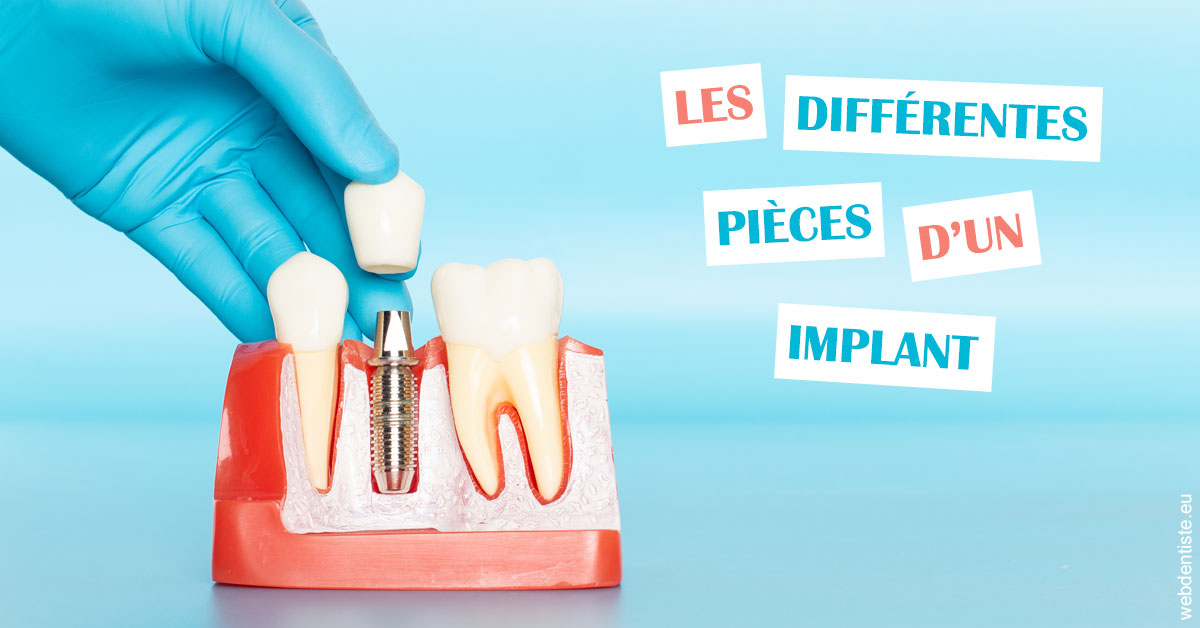 https://scp-aeberhardt-jahannot-pomel.chirurgiens-dentistes.fr/Les différentes pièces d’un implant 2