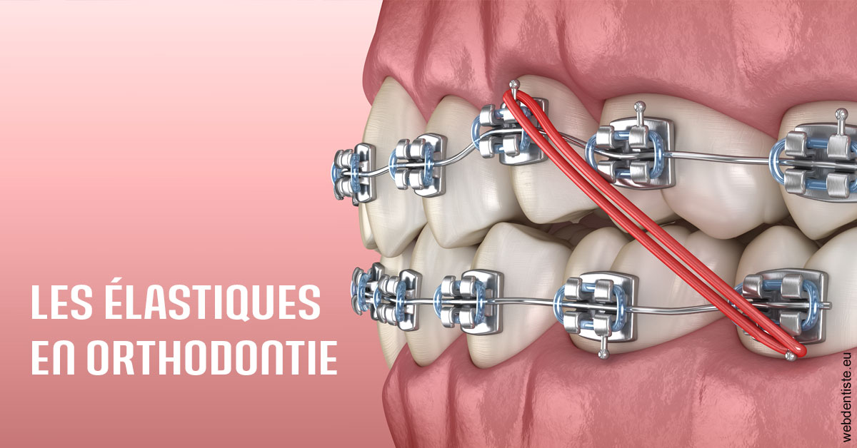 https://scp-aeberhardt-jahannot-pomel.chirurgiens-dentistes.fr/Elastiques orthodontie 2