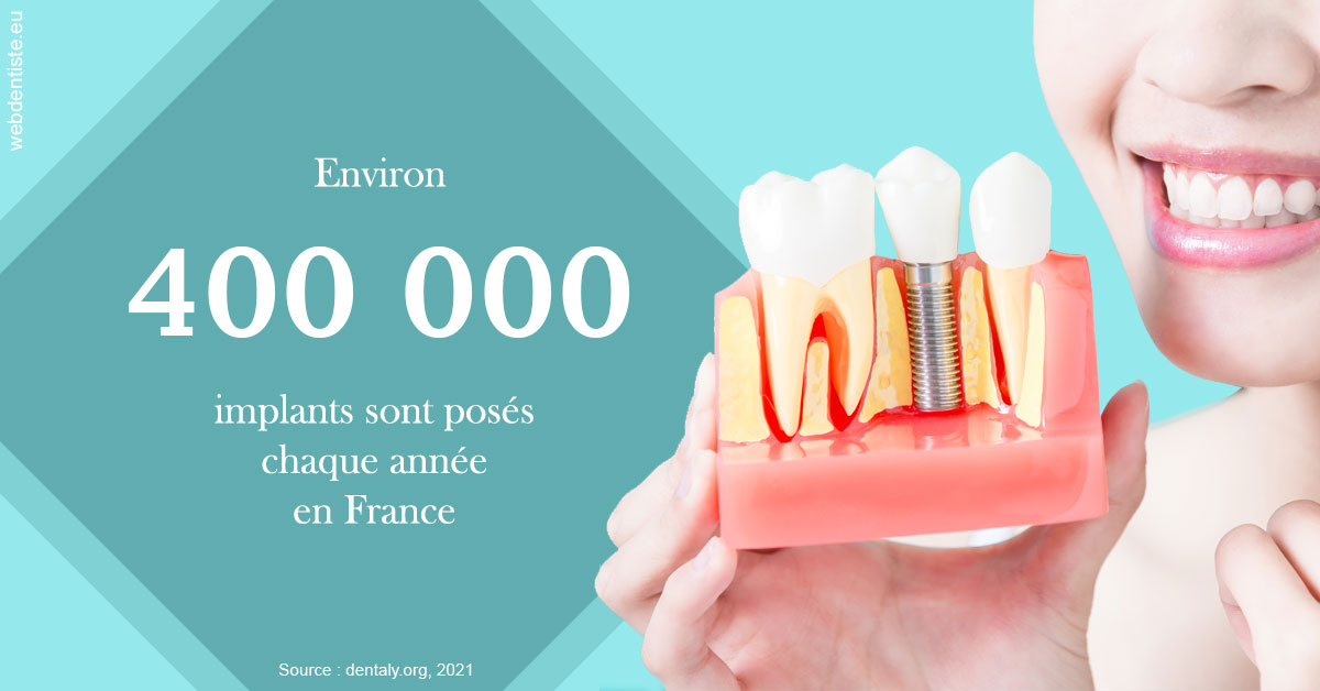 https://scp-aeberhardt-jahannot-pomel.chirurgiens-dentistes.fr/Pose d'implants en France 2